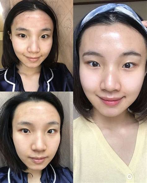 chanel shot|Chanel Injection: Koreans' Secret to Porcelain Skin .